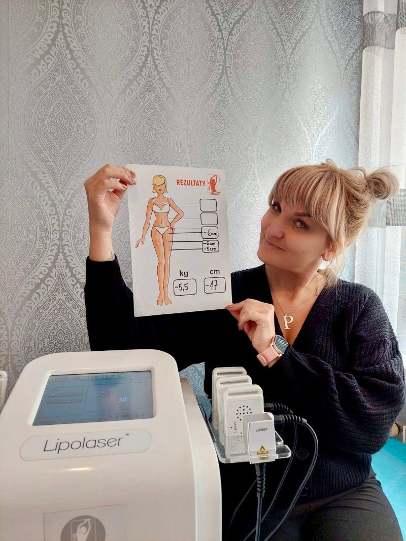 Klientka Studio Figura Częstochowa z kartą rezultatów po zabiegach lipolaserem (3)